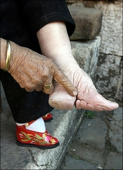 Feet Binding in China