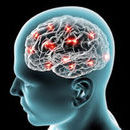 Photo: New Test Could Improve Diagnosis of Rare, Fatal Brain Disorder