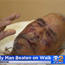 Photo: Man, 92, Hit With Brick In Brutal July 4th Attack, told "go back to your own country"